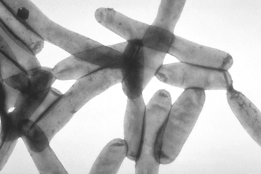 Legionella pneumophila